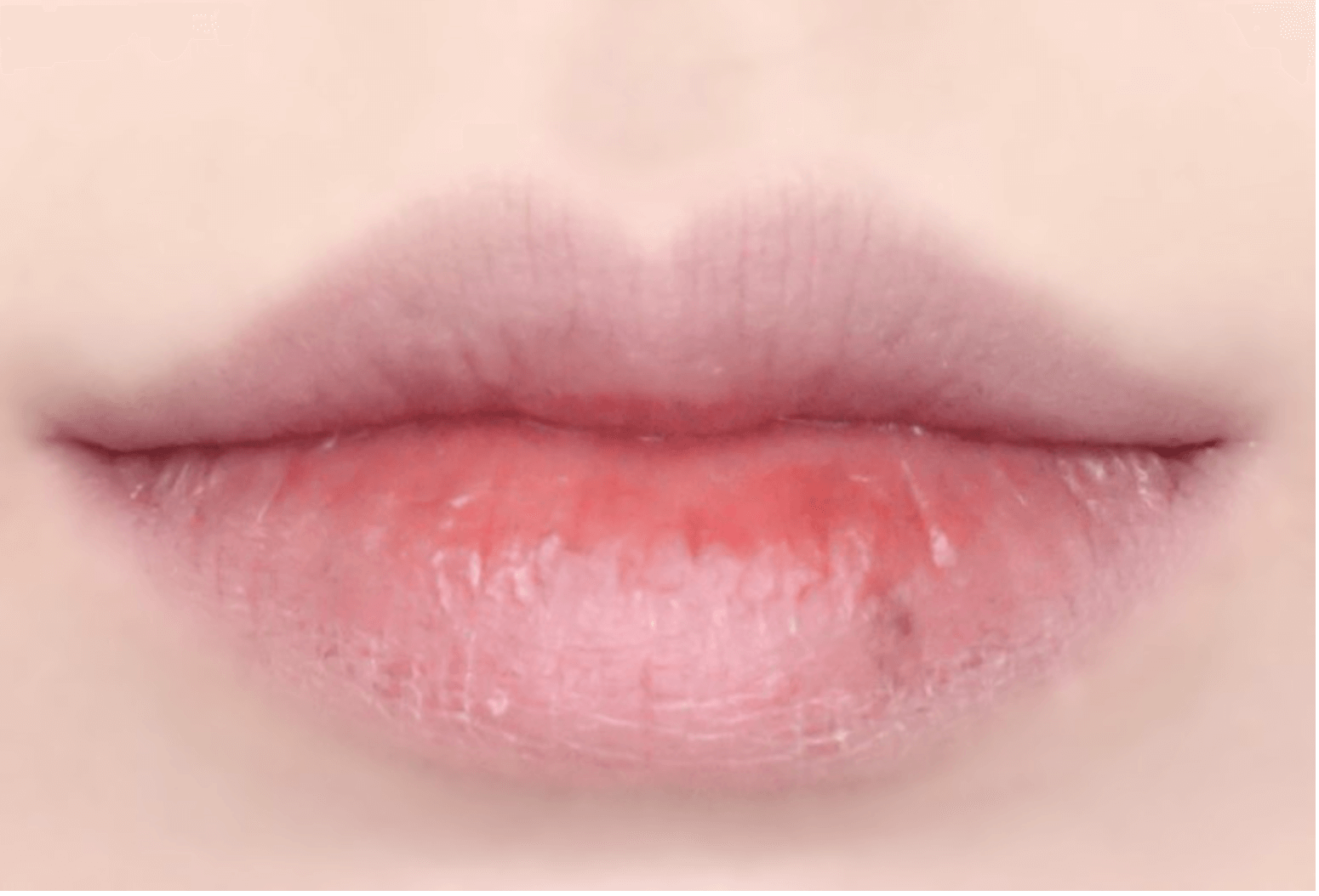 hidratar labios secos y partidos